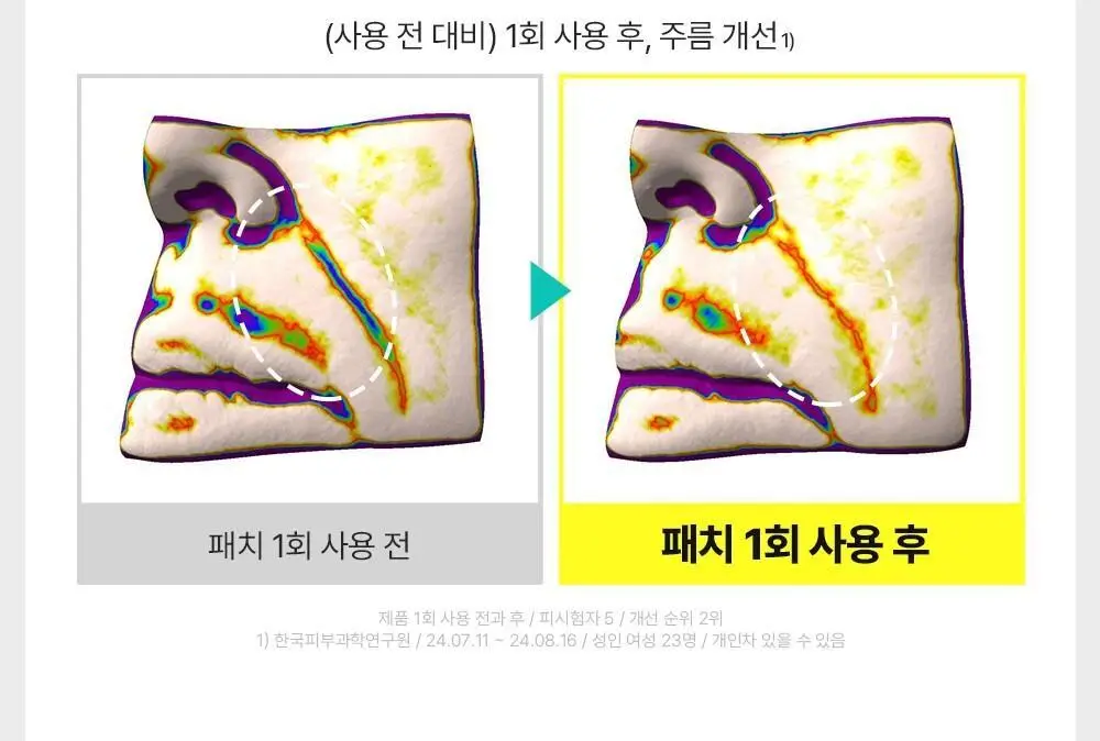 [아이백패치] 더마펌 비타액티브 마이크로크리스탈 패치플러스 3종 택1 상세페이지 17